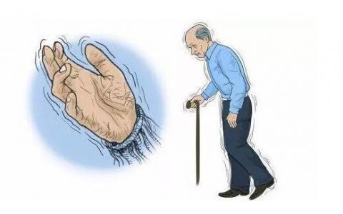 干细胞疗法让帕金森不再害怕，让患者看到新希望！