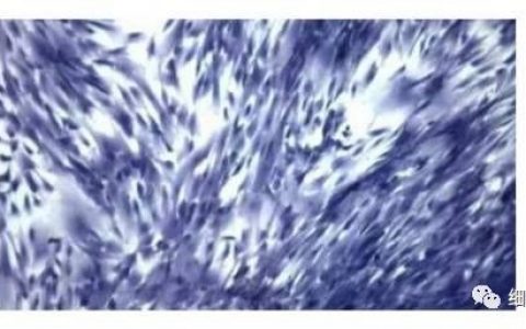 干细胞治疗前必读｜干细胞的14种基本特性