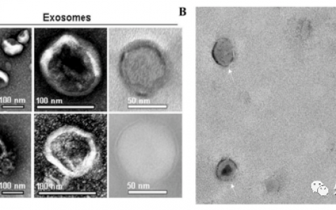 【综述】国家纳米科学中心：牛奶外泌体作为口服给药系统的前景探讨