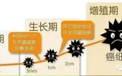 NK细胞丨人体免疫的广谱杀手，防癌、抵御病毒、抗衰老