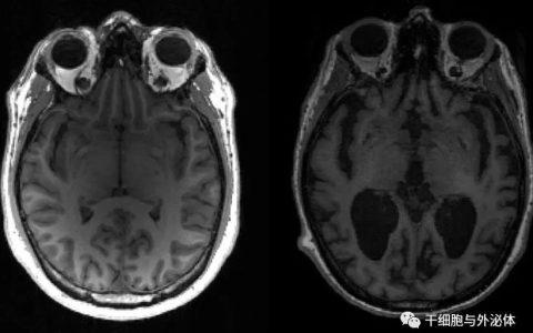 这家公司在外泌体市场带来了治疗脊髓损伤 (SCI) 的新方法