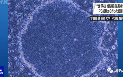 解析 | 首例IPS来源的神经细胞治疗脊髓损伤 三到五年才能见分晓