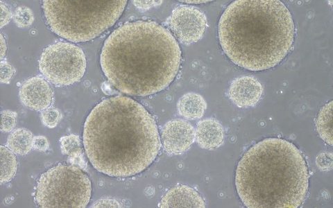 日本首次测试 iPS 细胞治疗脊髓损伤