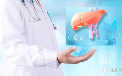 58例慢加急性肝衰竭患者，48周随访证实：输注干细胞可提高患者的长期生存时间