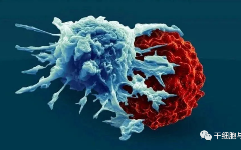 CAR-T细胞疗法在实体瘤中显示出“有限的成功”，但仍在进行“渐进式改变”