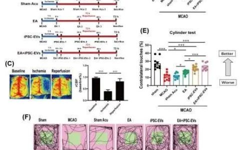 北京协和医院Cells |  穴位电针和人iPS细胞衍生的外泌体联合治疗缺血性脑中风