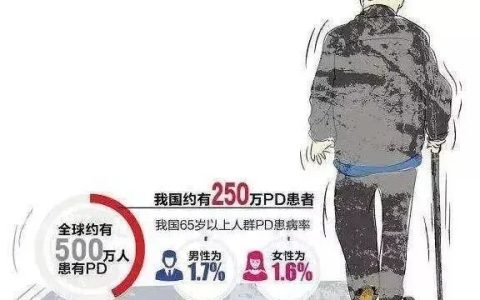 鞘内注射治疗20例帕金森患者的临床疗效和安全性研究