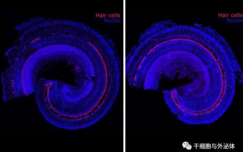 麻省理工学院 | 通过再生医学疗法逆转听力损失