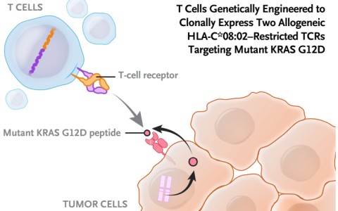 创造历史! “万癌之王”胰腺癌或将迎来药物克星: TCR-T免疫治疗新技术实现突破, 患者肿瘤消退72%！