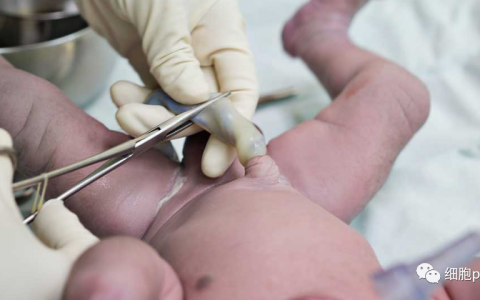 同是脐带间充质干细胞也有不一样的地方 临床效果当然有差异
