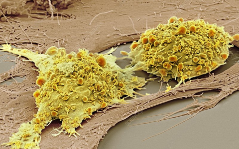 临床级间充质干细胞开发的技术壁垒：给药方式