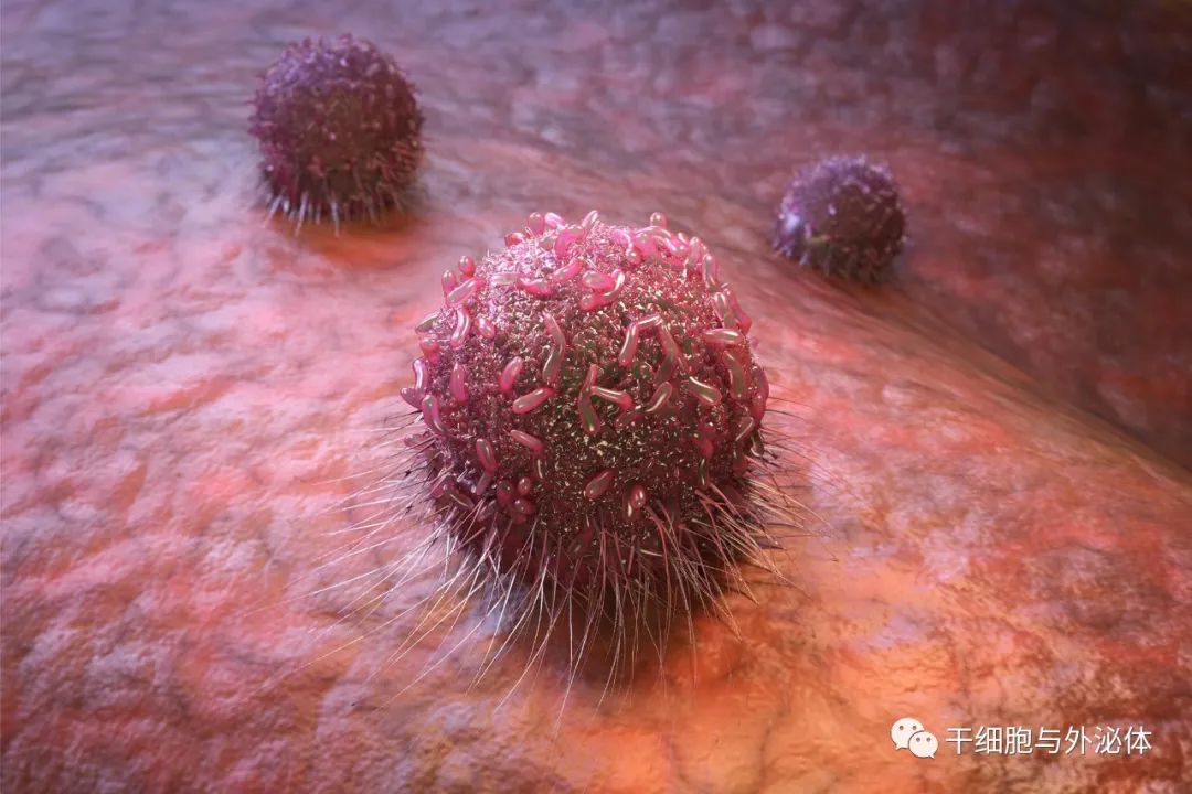 Leukemi | 将癌细胞转变为正常细胞