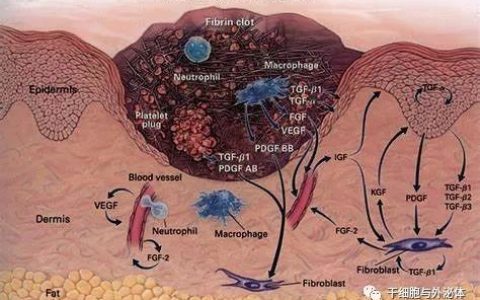 间充质干细胞促进创面愈合