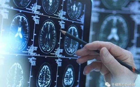 间充质干细胞在神经退行性疾病中的应用