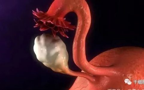 案例丨干细胞移植3个月，9例卵巢早衰患者有6例月经恢复，1例成功受孕