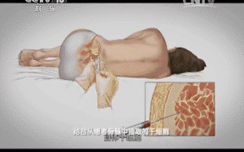 CCTV报道：干细胞修复子宫内膜，让更多的女性当上妈妈！