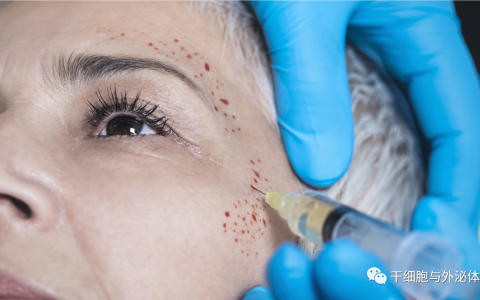 富血小板血浆（PRP）在皮肤抗衰老中的应用
