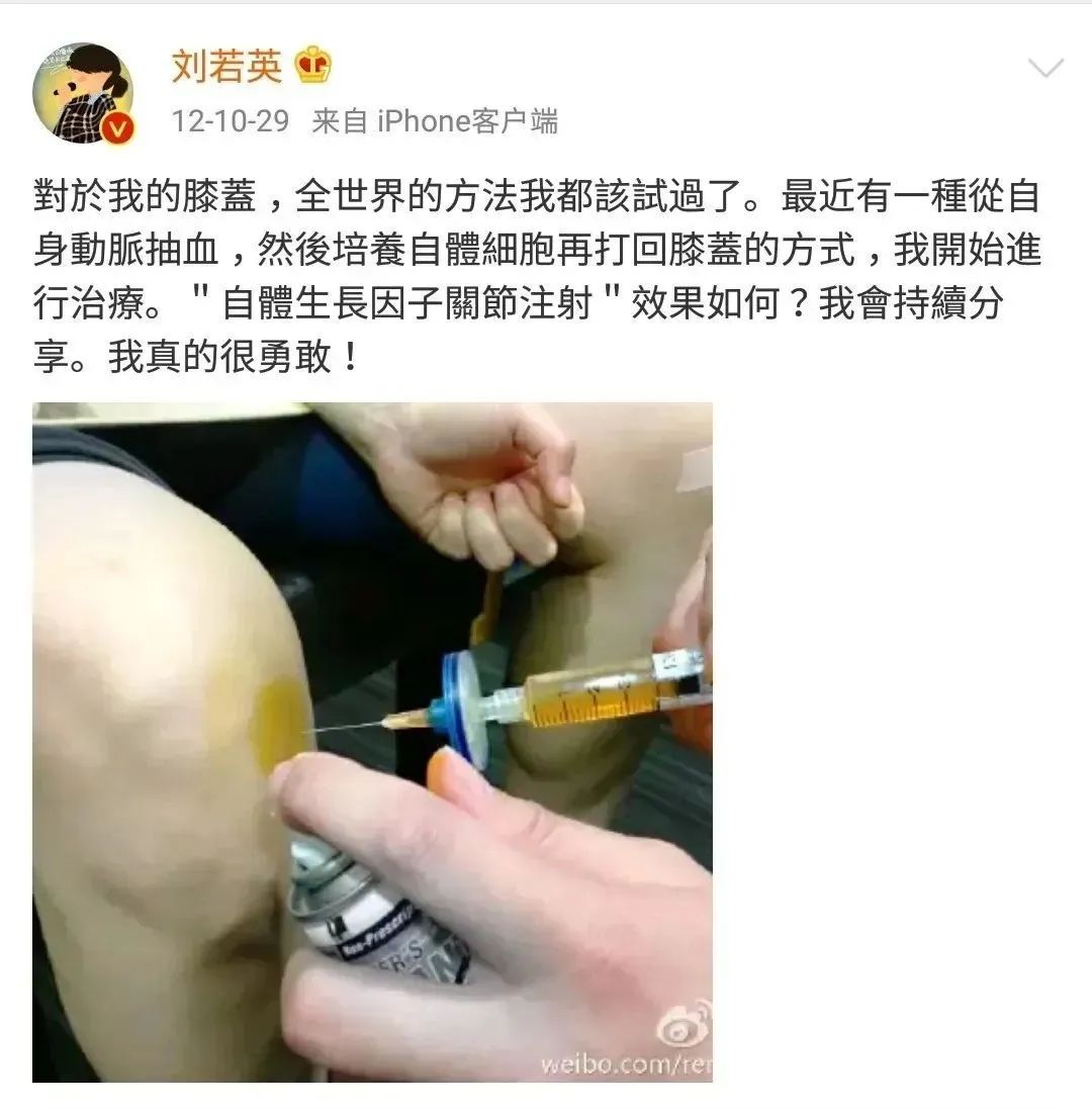 当你还在质疑时，这些名人明星早已用上干细胞了