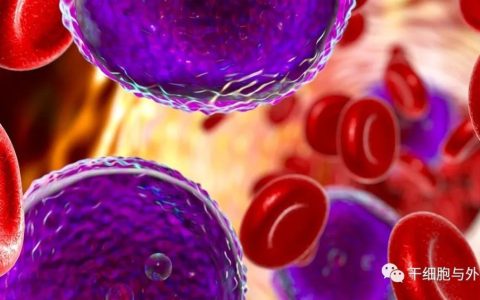 NK细胞在白血病治疗中的应用