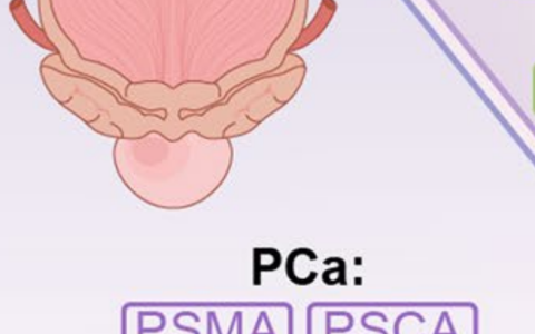 肺癌、胃癌、胰腺癌、乳腺癌等，12大常见实体瘤CAR-T疗法进展全览（二）