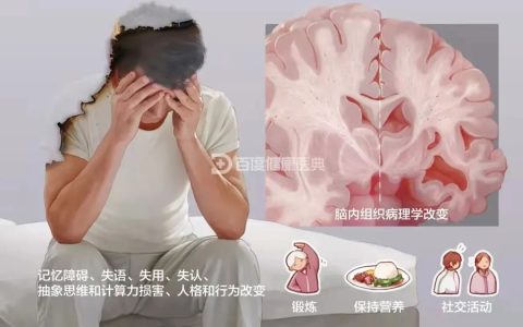 超400篇研究结论证实，干细胞疗法对阿尔兹海默症改善明显且安全