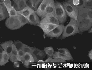 干细胞助力C罗，成就足坛历史射手王