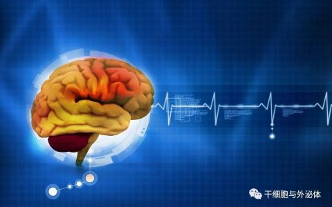 静脉注射间充质干细胞治疗中风患者IIb/III期临床试验启动