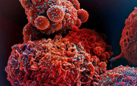 新发现新冠病毒感染削弱了免疫细胞对疫苗的反应