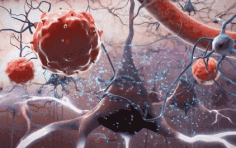 案例：干细胞疗法帮中风患者恢复正常生活