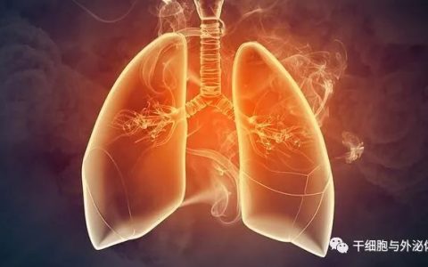 全球首个 | 间充质干细胞注射液治疗间质性肺病临床试验申请获得受理