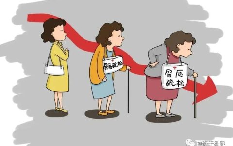 干细胞为健康加“骨”劲，有效改善骨质疏松症