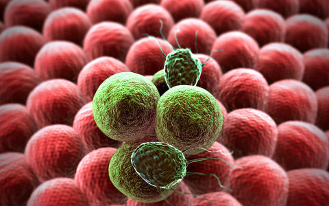 术后转移复发才是死亡的主要原因，回输免疫细胞可有效预防！