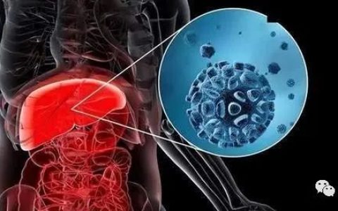 肝癌术后复发伴肺部转移，细胞免疫疗法成功消除肿瘤