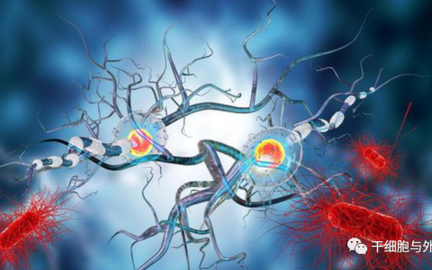 兰州军区兰州总医院19例帕金森患者，间充质干细胞治疗症状改善明显