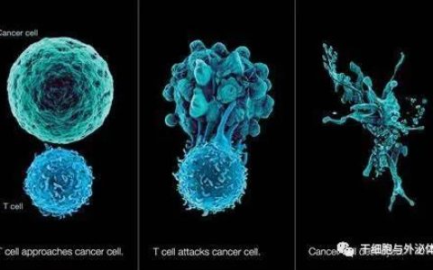 临床试验超100项，TCR-T细胞疗法获得令人鼓舞的临床效果