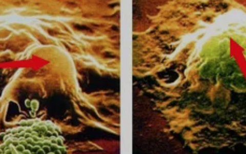 免疫细胞科普：CIK细胞和NK细胞有什么区别？