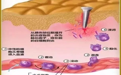 间充质干细胞：有效逆转慢性炎症，将癌症扼杀在摇篮中！