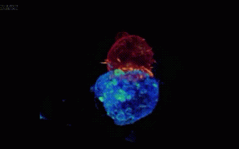 治疗后10年无癌！这些“优质”的免疫细胞有望清除晚期癌症患者的肿瘤！