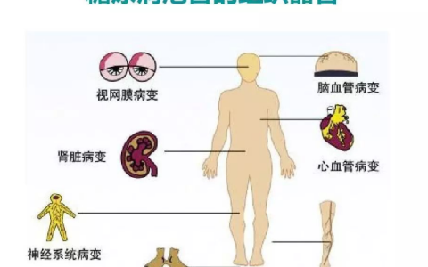 关于糖尿病并发症，干细胞能起到什么关键性作用？