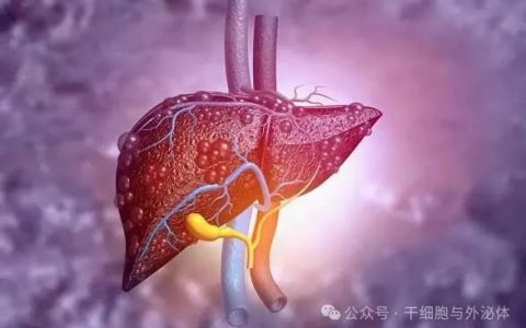 海军905医院：NK细胞治疗肝癌10例，生活质量明显提高