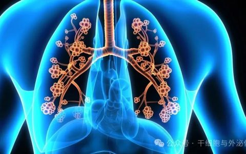 患者4500万，间充质干细胞移植可有效减轻哮喘发病率