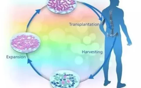 普通人回输干细胞需要注意些什么