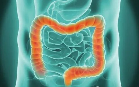 872例：NK细胞活性低患直肠癌的风险高10 倍，回输NK细胞