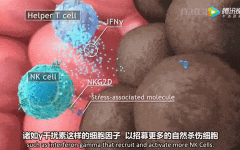绝境逆袭：17次NK细胞回输，晚期肝癌患者如何改写“生命终章”？