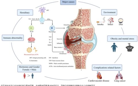 干细胞疗法真能治好类风湿关节炎吗？医生怎么说