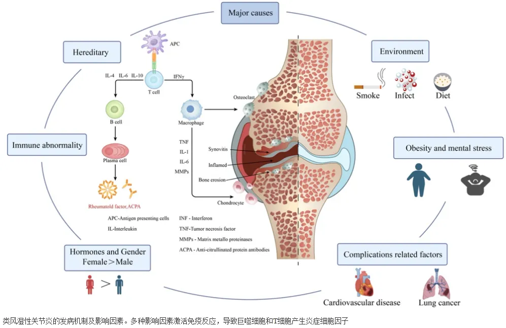 干细胞疗法真能治好类风湿关节炎吗?医生怎么说