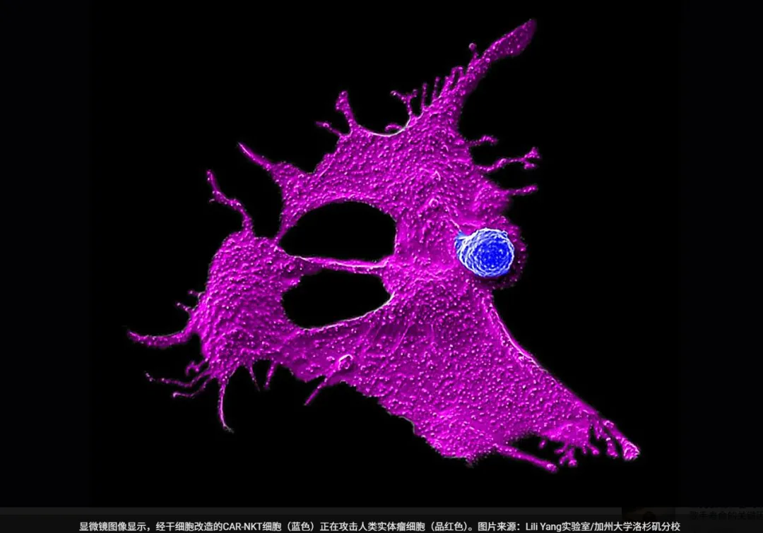 一袋脐带血，千剂细胞药：干细胞技术为“癌王”带来通用免疫细胞治疗新思路